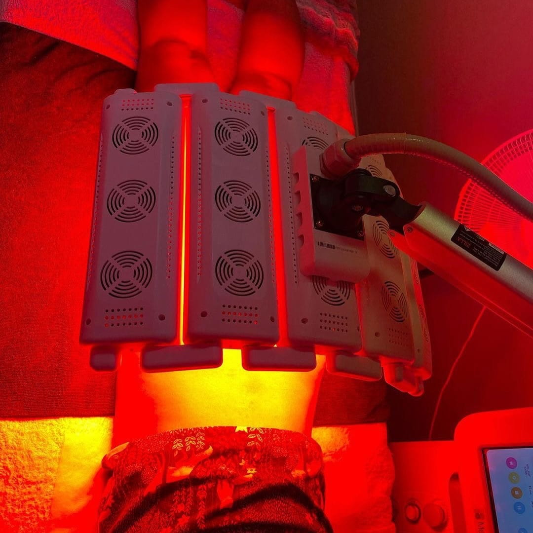 Laser_Preparation