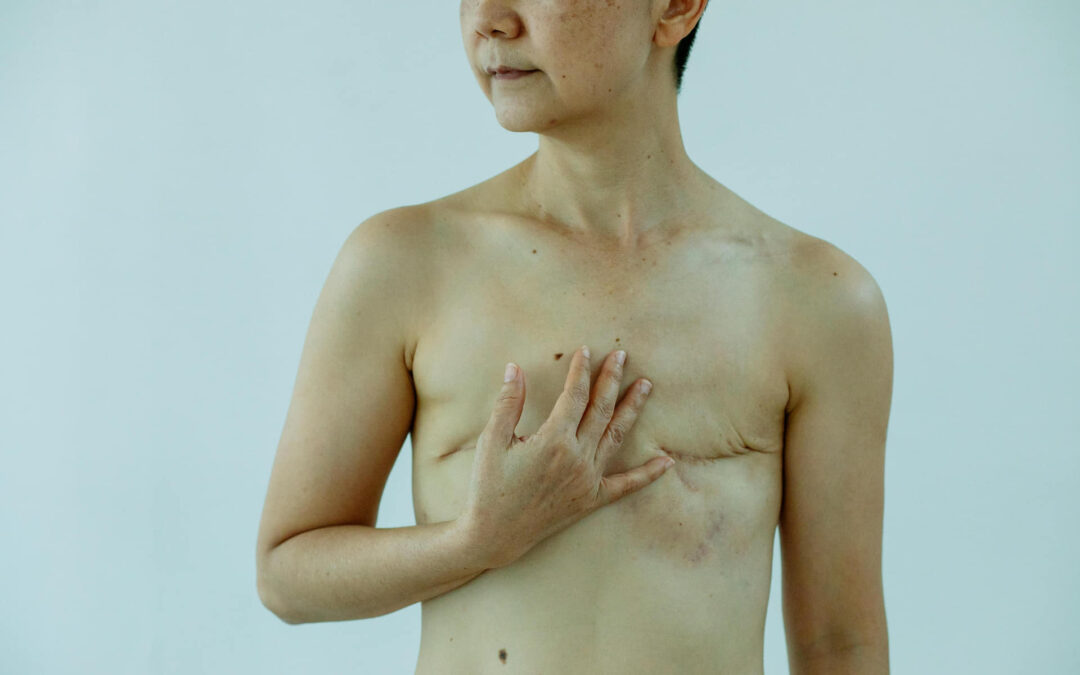 Unveiling the Story Beneath: Understanding Skin Scars and Their Treatment