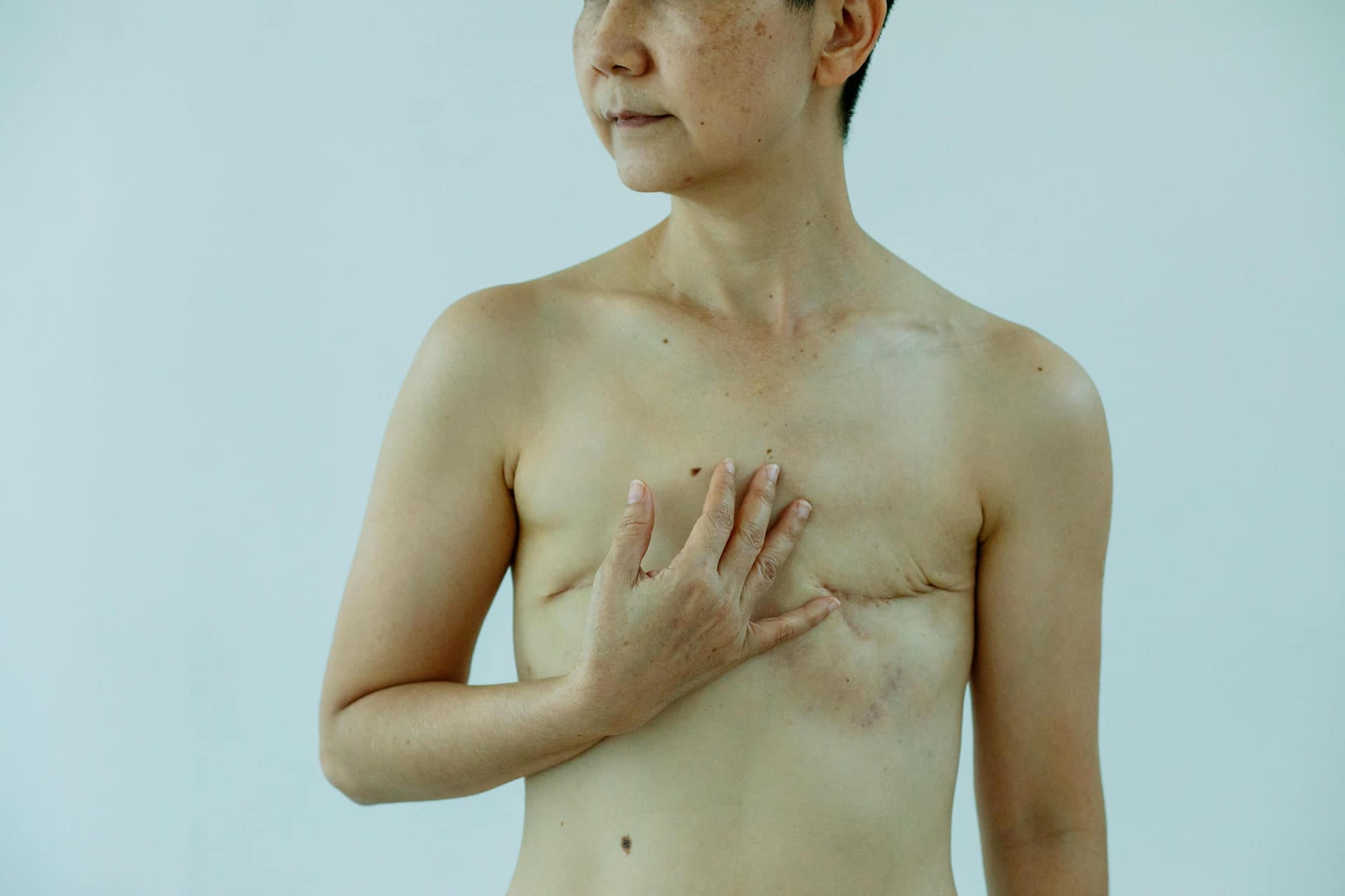 Unveiling the Story Beneath: Understanding Skin Scars and Their Treatment