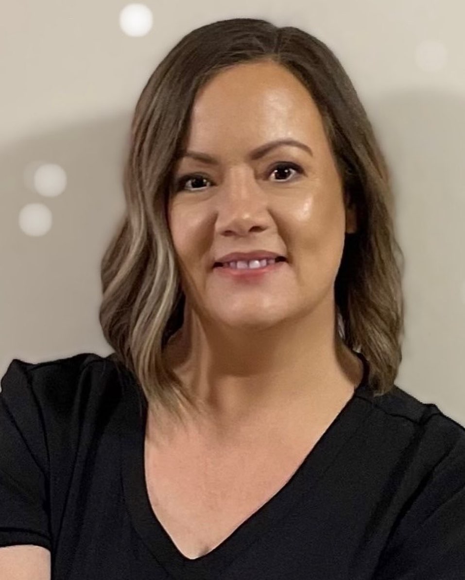 Marnie | Scar Treatment Perth Marnie | Scar Treatment Perth