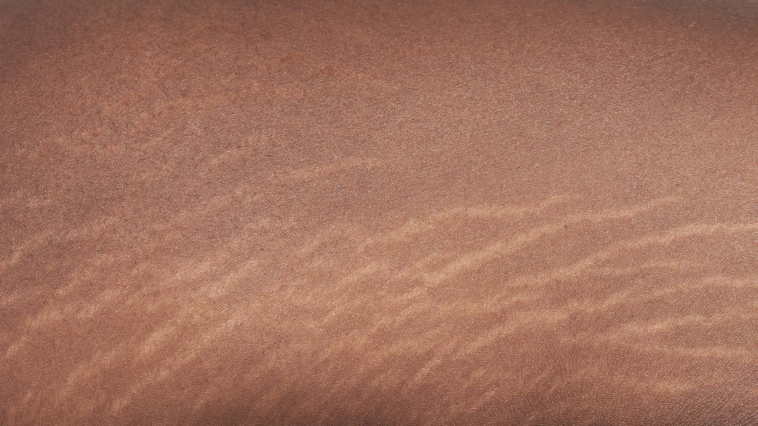 Stretch Mark Treatment Perth