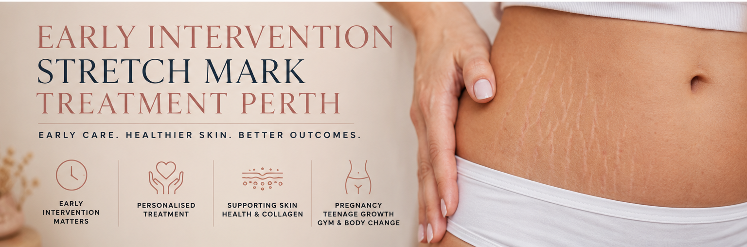 Early Intervention Stretch Mark Treatment Perth | Scar Treatment Perth